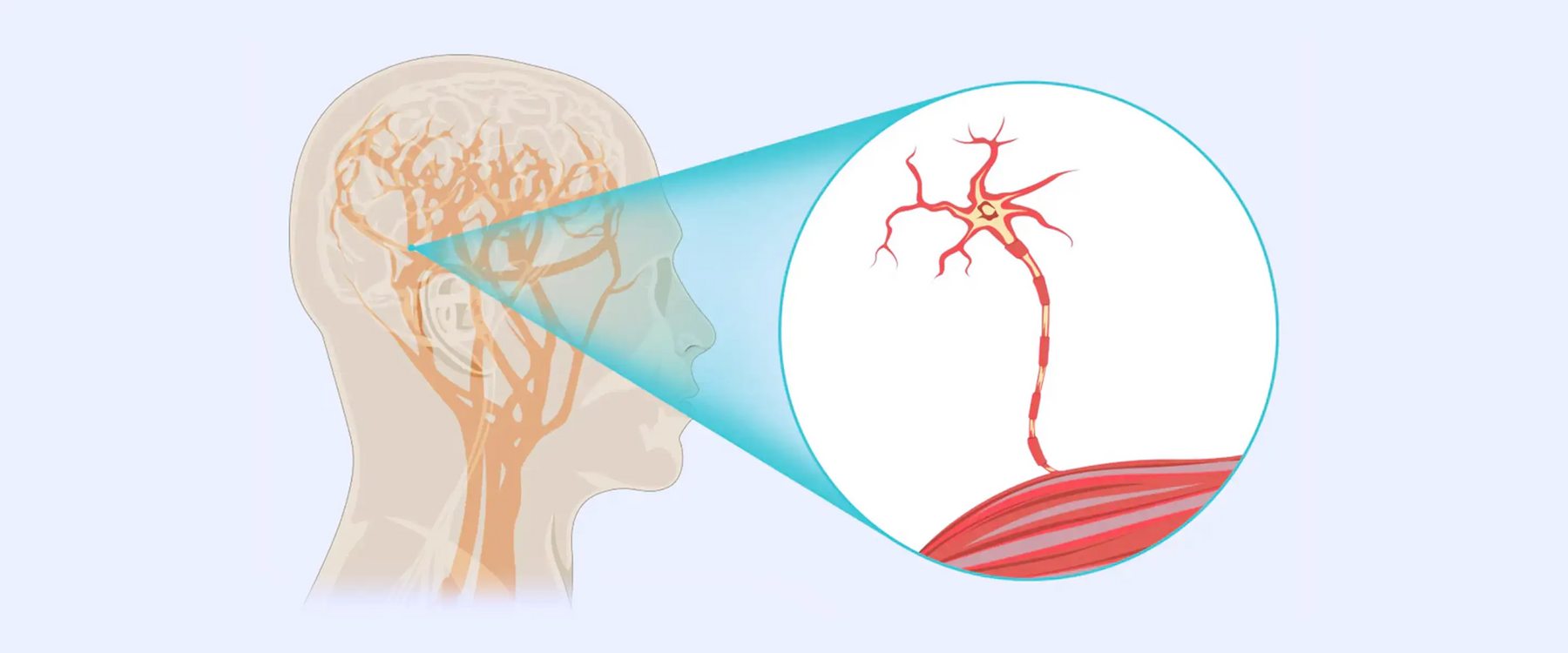 Human Brain Nerve Damage