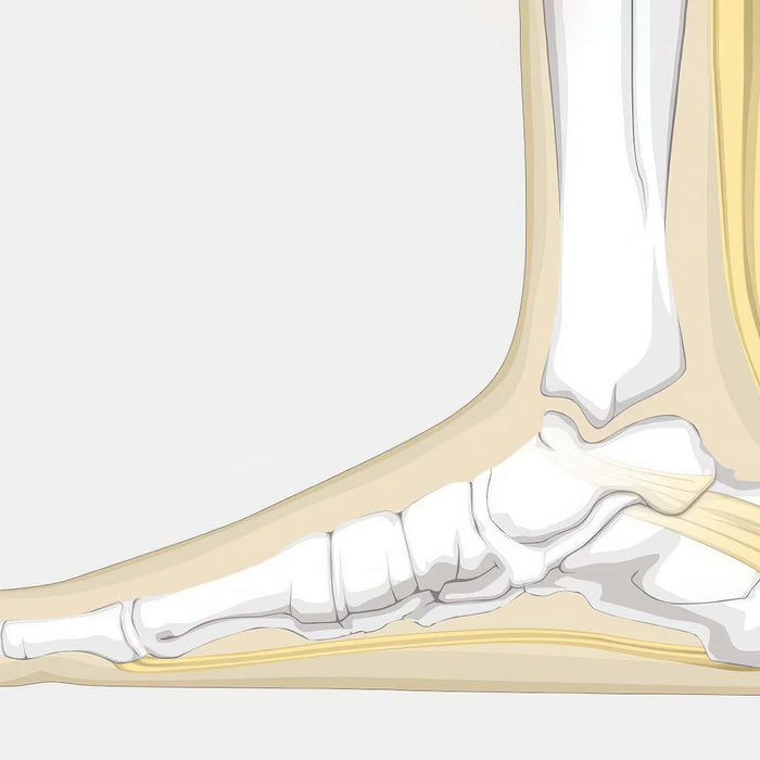 Achilles Bursitis Illustration