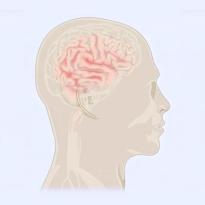 Alzheimer's Disease Illustration