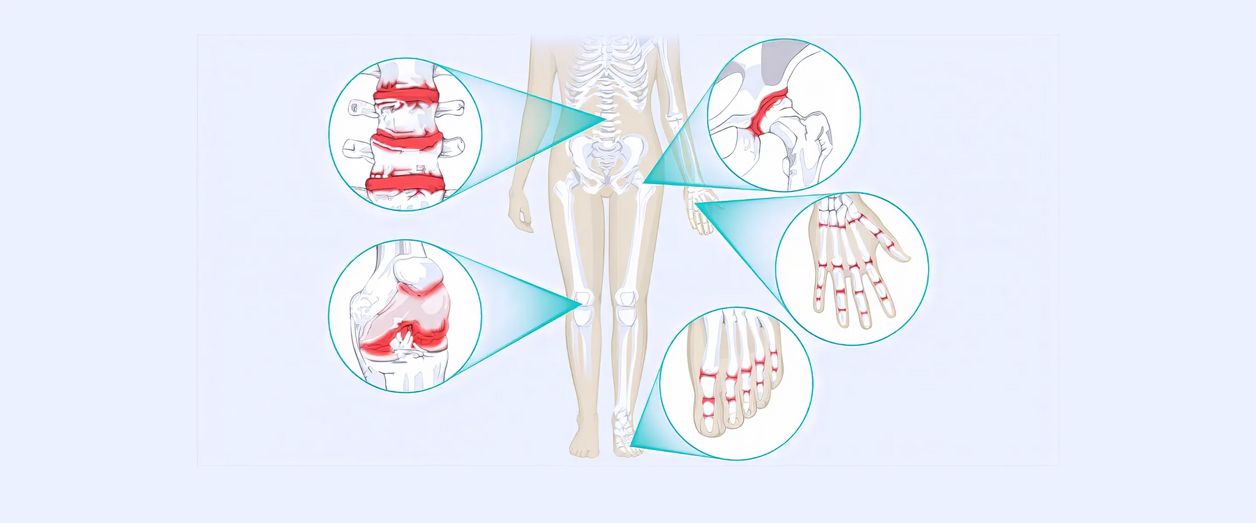 Common arthritis in human body