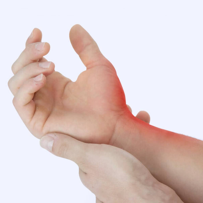 De Quervain’s Tenosynovitis Pain