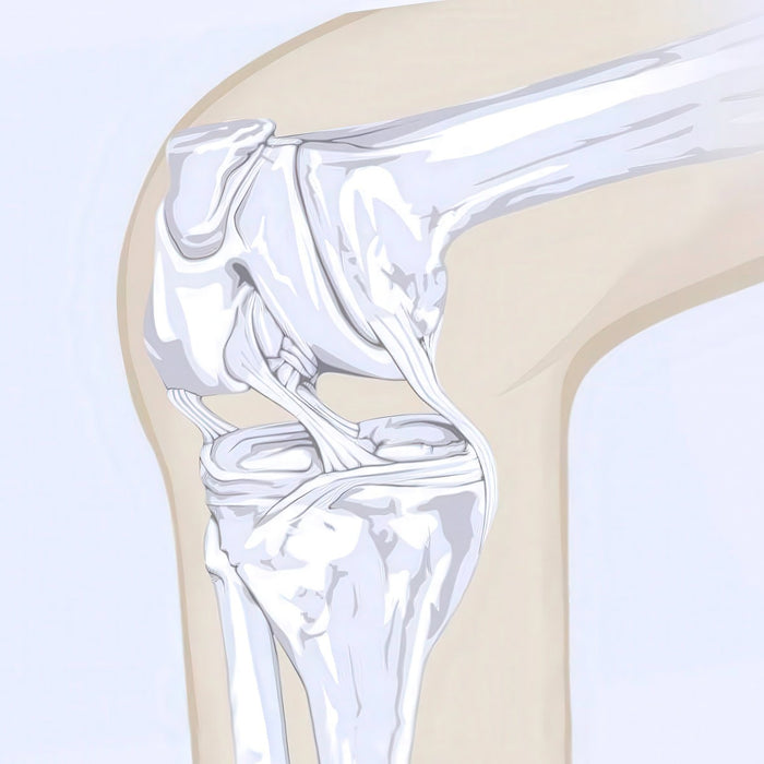 Dislocated Knee Illustration