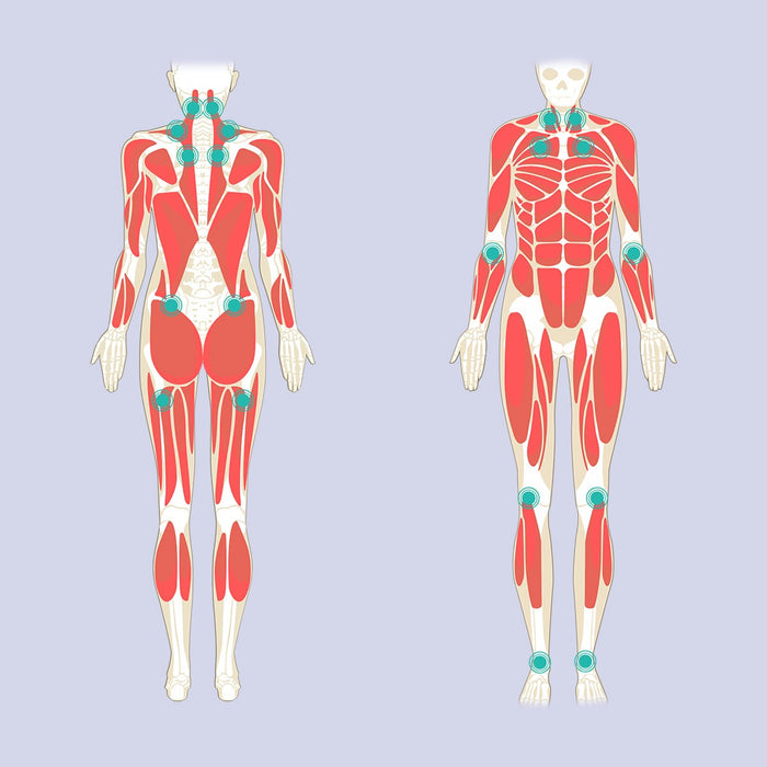 Fibromyalgia Diagram