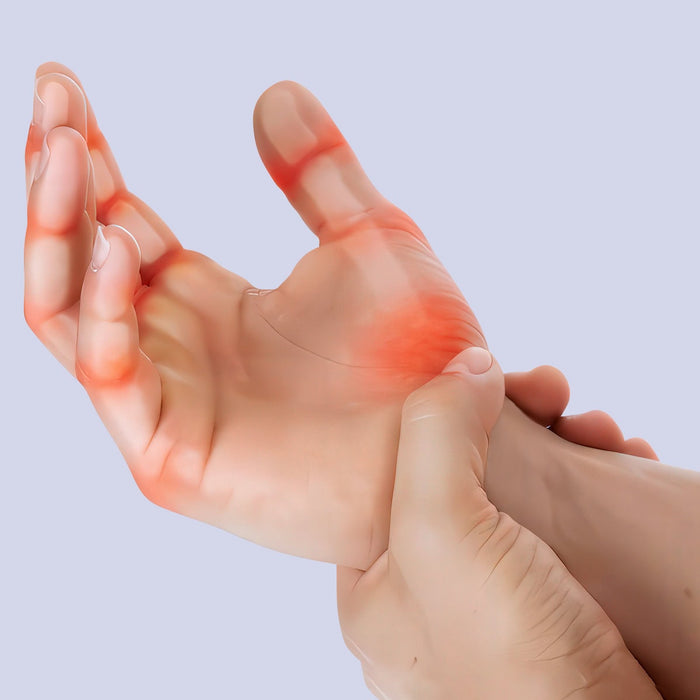 Hand Arthritis