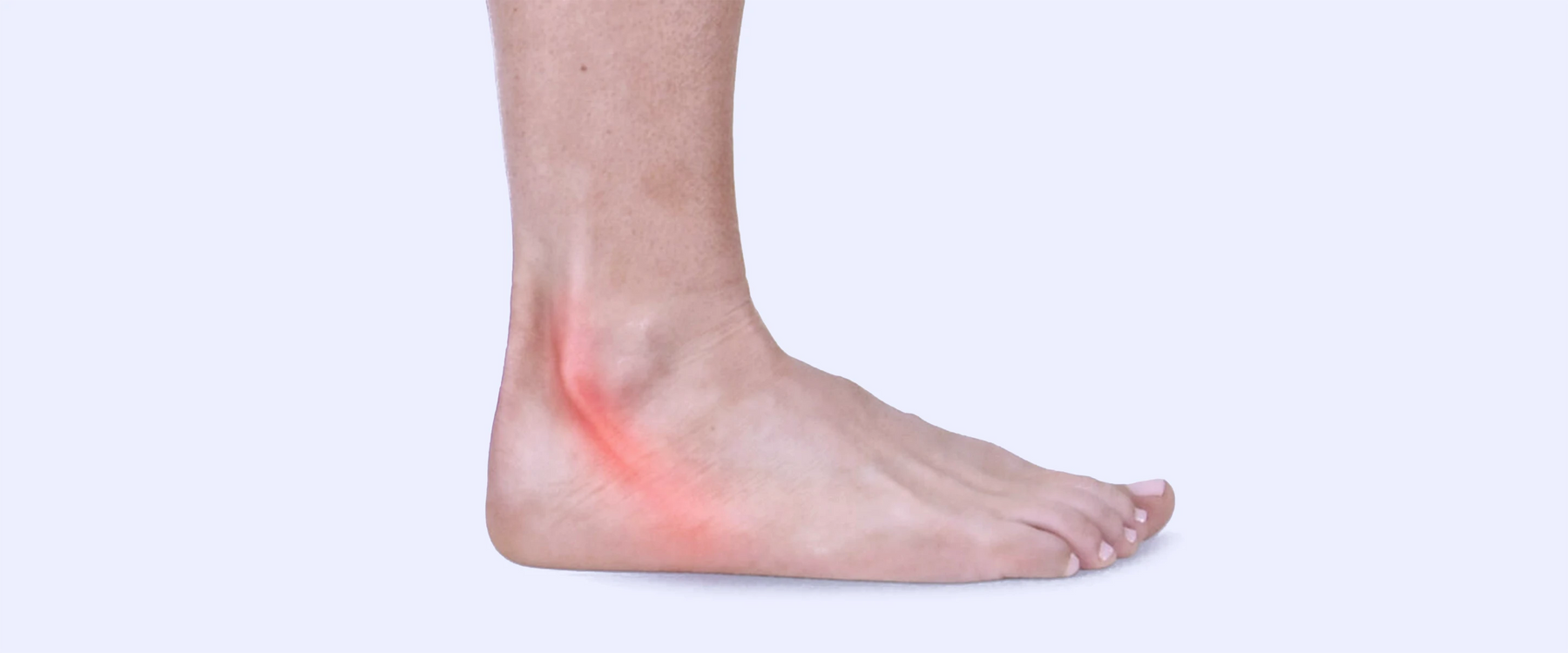 Peroneal Tendonitis Pain