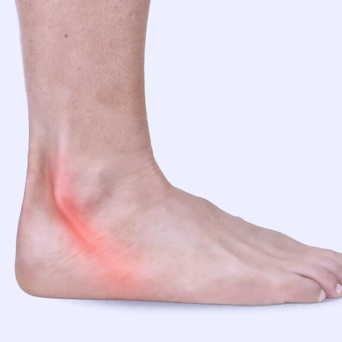 Peroneal Tendonitis Pain