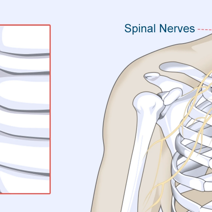 Pinched-Nerve-Diagram