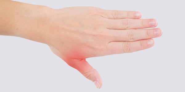 Sprained thumb: Treatment, recovery, and symptoms