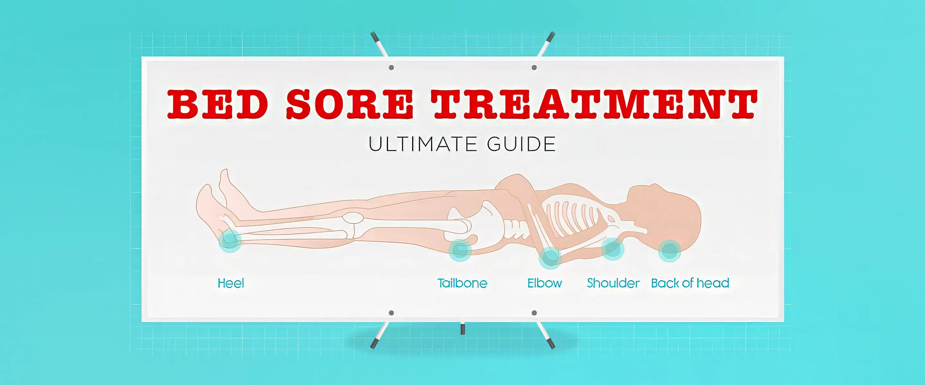 bed sore treatment ultimate guide