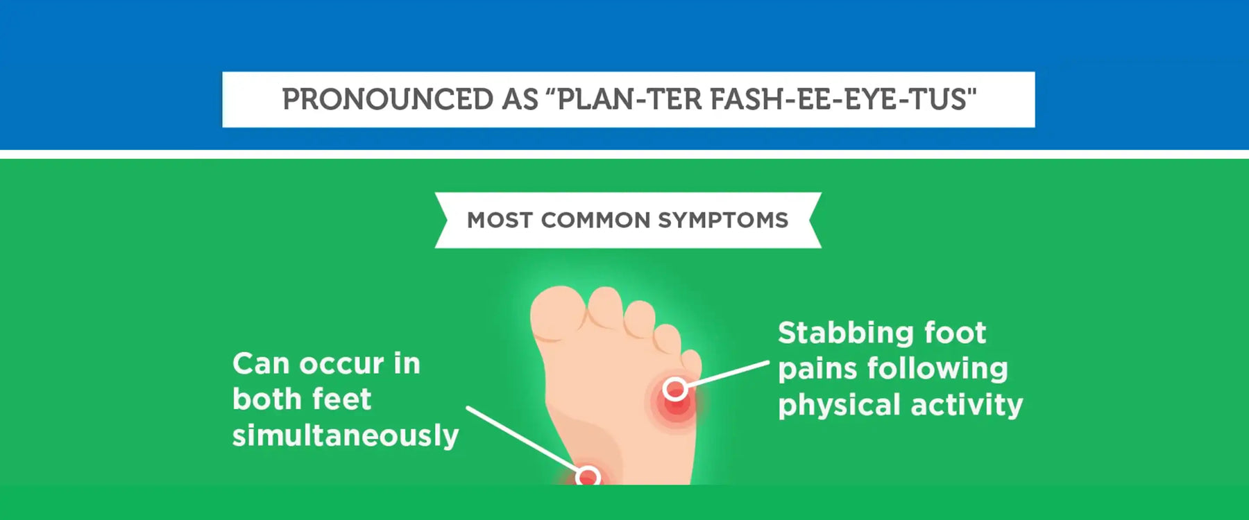 plantar fasciitis infographic