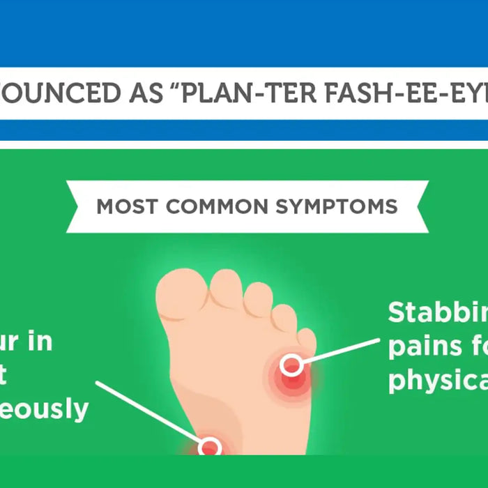 plantar fasciitis infographic